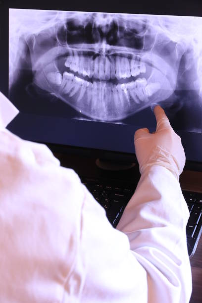 Best Emergency Tooth Extraction in Buckhead Ridge, FL